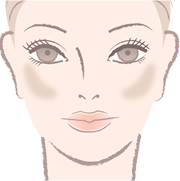 肝斑(かんぱん)